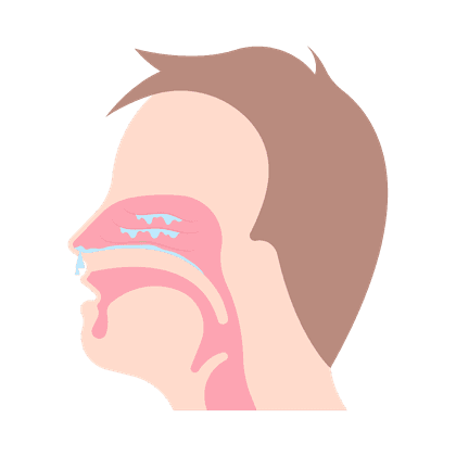Sinusitis, sinusitis, sinusitis frontal