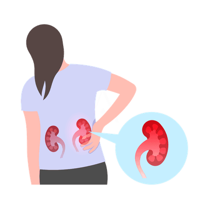 Urolitiasis