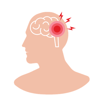Stroke (dukungan pemulihan)