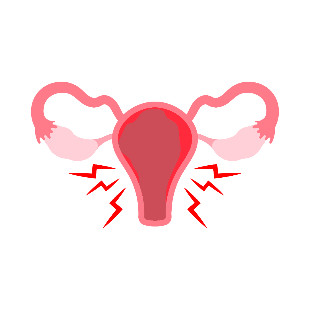Endometriosis