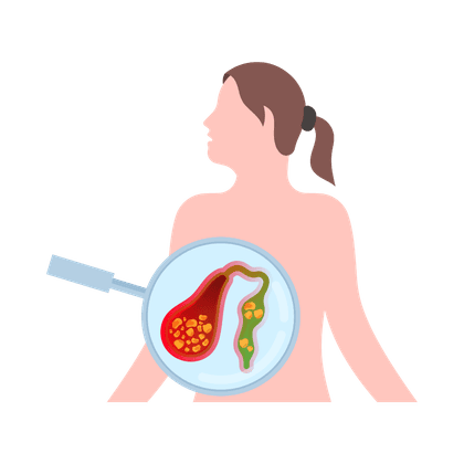 Stasis empedu (kolestasis)